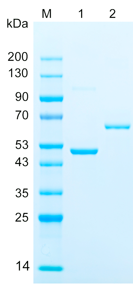重组人PRKAR1B蛋白