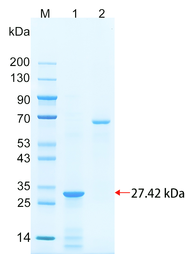 重组人ALKB5蛋白