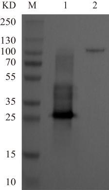 Western Blot of recombinant ACHB (His tag) with anti-His-tag antibody.